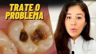 How to relieve a holed toothache / Make these home remedies for a holed and inflamed toothache