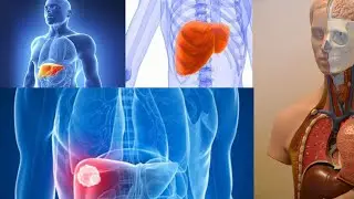 Foods to Help Fatty Liver Reversal