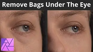 How To Remove Bags Under The Eye - Affinity Photo Tutorial