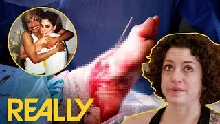 8-Hour Surgery to Repair “Worst Case of Dancer’s Feet” | My Feet Are Killing Me