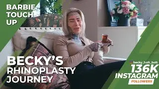 Becky Holt's Rhinoplasty & Blepharoplasty Journey