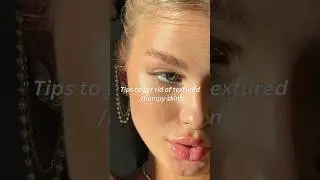 How to get rid of textured/bumpy skin? 