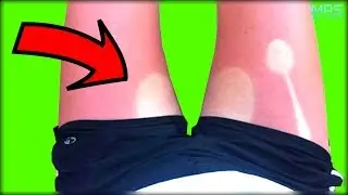 People Who Are Having A Worse Day Than You - #1