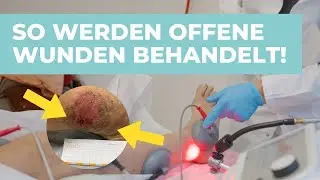 Reha Experte klärt auf! So werden offene Wunden nachhaltig behandelt!