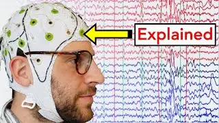 EEG (Electroencephalogram) Explained