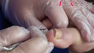 МК  САХАЛИНСКИЙ КРАСАВЕЦ В ГОСТЯХ У ЕЛЕНЫ ДЗЫК