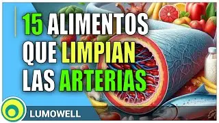 Atherosclerosis: 15 Foods That Clean Your Arteries