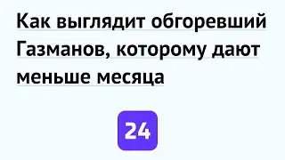 Как выглядит обгоревший Газманов, которому дают меньше месяца