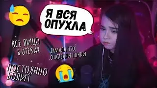 Юечка Про Осложнения от Удаления Зубов 😨 Рассказала Тайны про Мокривского 🤣