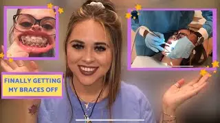 Getting My Braces Off at 22 ✨