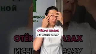 Как убрать отек на глазах.