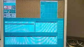 субтракция ge mri   //// subtraction ge mri
