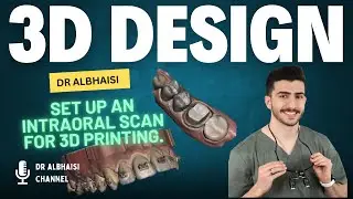 Set Up an intra-oral scan for 3D printing