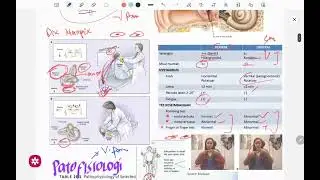 Latihan soal UKMPPD - Veritigo: BPPV, Meniere disease, Labirinitis, Vestibular neuritis