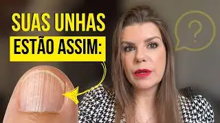 Unhas em PERIGO! Descubra os sinais que elas estão te dando!