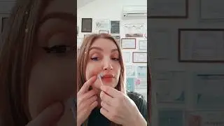 Депиляция усов. Шугаринг лица. 