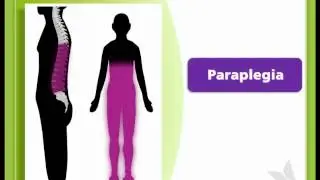 SCI & You 1.2-Paraplegia and Quadriplegia