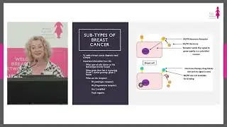 Medical Oncologist Dr Michelle White - Early Stage Breast Cancer - Mission Beach Information Forum