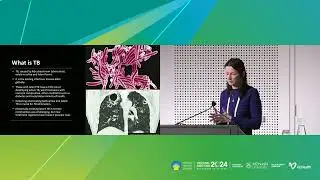 WHS Regional Meeting 2024 - Management of Tuberculosis in Aboriginal communities: health disparities