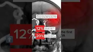 What is a TIA (Transient Ischemic Stroke)?