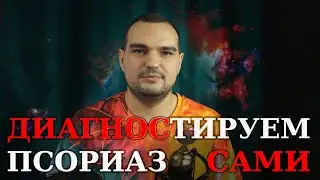 КАК ДИАГНОСТИРОВАТЬ У СЕБЯ ПСОРИАЗ 