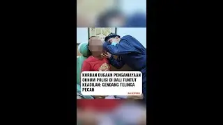 Korban Dugaan Penganiayaan Oknum Polisi di Bali Tuntut Keadilan: Gendang Telinga Pecah