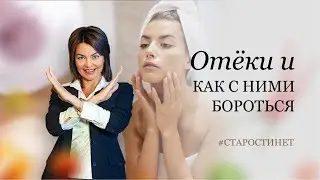 Отёки и как с ними бороться. / доктор Елена Бахтина, организатор движения 