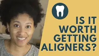 Is It Worth Getting Aligners | Reviewing My Aligners