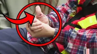 Une blessure horrible prise en photo | Juste pour rire Gags