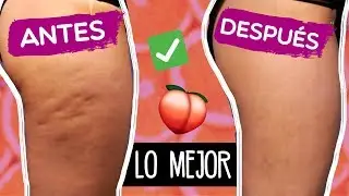 QUITA LA CELULITIS  ¡YAA! 🍑(DEBES VERLO) ✅