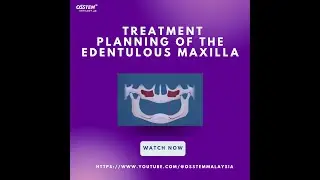 [Master Course - PROSTHODONTICS] Treatment planning of the edentulous maxilla