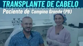 Transplante Capilar em um paciente de Campina Grande (Paraíba)