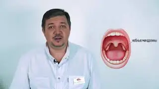 Налет на миндалинах
