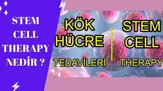 Stem Cell Terapi  (Kök Hücre) Nedir ?
