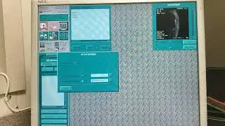 автоотправка снимков ge  //////   auto-send images ge MRI