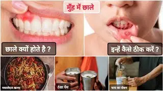 muh ke chhale kaise thik kare 🔥 रामबाण इलाज