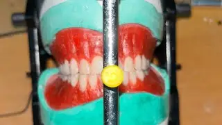 Complete Denture processing Full process step by step  , Prosthodontics