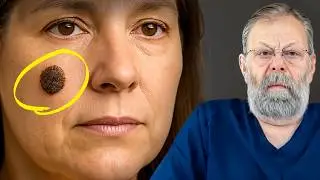 What Do Keratomes Under the Breast Mean?