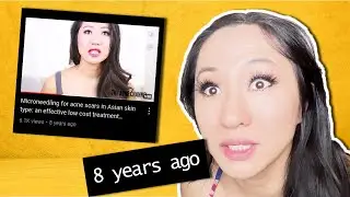 MICRONEEDLING PROVEN TO HELP ACNE SCARS IN ASIAN SKIN?
