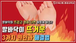 발바닥이 뜨거운/발이 화끈거리는 증상, 3가지 원인과 해결법(AKA 발에 열나는 족심열)
