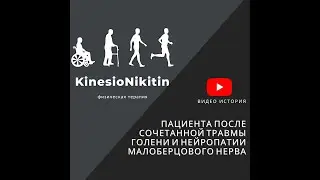 Перелом малоберцовой и большеберцовой кости. 2 недели реабилитации