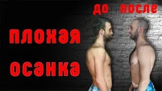 Плохая осанка! Путь к исправлению! Часть 2 - Результаты!