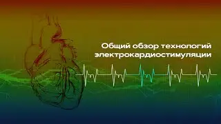 Общий обзор технологий электрокардиостимуляции