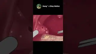 ASMR Animation | Get Rid of Bad Breath! Tonsil Stone Removal! | Meng's Stop Motion