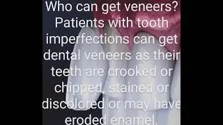 who can get veneers?#veneers