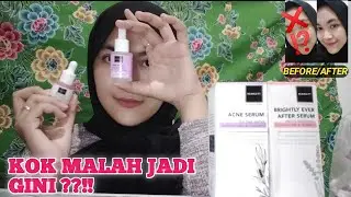 REVIEW JUJUR SERUM SCARLETT !!! WAJIB NONTON SEBELUM BELI !!!