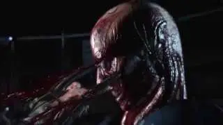 Mortal Kombat X-RAYS