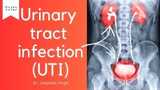 urinary tract infection essential guide
