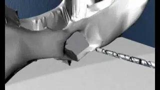 Лечение вывиха тазобедренного сустава собаки.wmv