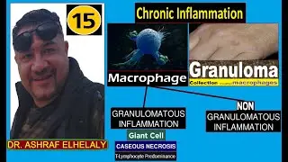 15- General Haematology|Monocyte |Macrophages|Giant cells|caseous necrosis|Lymphocytes predominant